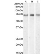 Western blot analysis of Rat Colon (A), Lung (B) and Spleen (C) lysate (35 µg protein in RIPA buffer) using ITK antibody ((A): 0.3 µg/ml, (B): 0.5 µg/ml, (C): 1 µg/ml). IHC-P analysis of paraffin embedded Human Spleen tissue using  ITK antibody (3.75 µg/ml).