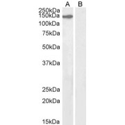 abx432892 (2 µg/ml) staining of nuclear NIH3T3 (A) and (2 µg/ml) negative control Human Ovary (B) lysate. (35 µg protein in RIPA buffer) Detected by chemiluminescence.