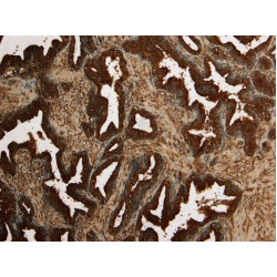 Kallikrein 2 (KLK2) Antibody
