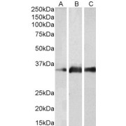 abx432899 (2 µg/ml) staining of Human Brain (Cerebellum) (A), Mouse Brain (B) and Rat Brain (C) lysates (35 µg protein in RIPA buffer). Primary incubation was 1 hour. Detected by chemiluminescence.