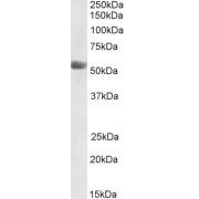 abx432903 (0.03 µg/ml) staining of Human Placenta lysate (35 µg protein in RIPA buffer). Primary incubation was 1 hour. Detected by chemiluminescence.