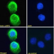 abx432913 Immunofluorescence analysis of paraformaldehyde fixed A431 cells, permeabilized with 0.15% Triton. Primary incubation 1hr (10 µg/ml) followed by AF488 secondary antibody (2 µg/ml), showing cytoplasmic staining. The nuclear stain is DAPI (blue). Negative control: Unimmunized goat IgG (10 µg/ml) followed by AF488 secondary antibody (2 µg/ml).