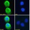 La Ribonucleoprotein Domain Family Member 2 (LARP2) Antibody
