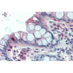 LIM And SH3 Domain Protein 1 (LASP1) Antibody