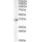 LIM And SH3 Domain Protein 1 (LASP1) Antibody