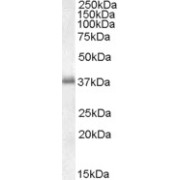 abx432915