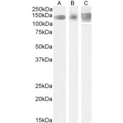 Western blot analysis of Human Cerebellum (A), Mouse Fetal Brain (B) and Rat Brain (C) lysate (35 µg in RIPA buffer) using Leptin Receptor (LEPR) Antibody (1.75 µg/ml).