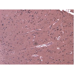 Probable ATP-Dependent RNA Helicase DHX58 (DHX58) Antibody
