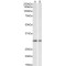 lysyl Oxidase (LOX) Antibody