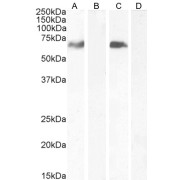 abx432949 (0.5 µg/ml) staining of Human Prostate lysate (35 µg protein in RIPA buffer). Primary incubated for 1 hour. Detected by chemiluminescence.