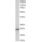Malignant T-Cell Amplified Sequence 1 (MCTS1) Antibody