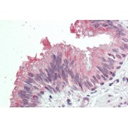 abx432955 (5 µg/ml staining of paraffin embedded Human Lung. Steamed antigen retrieval with citrate buffer pH 6, AP-staining.