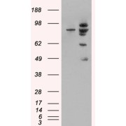 HEK293 overexpressing MDM2 and probed with abx432957 (mock transfection in first lane).