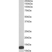 abx432969 (0.01 µg/ml) staining of Daudi (A) and Jurkat (B) lysate (35 µg protein in RIPA buffer). Detected by chemiluminescence.