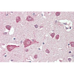 Membrane Protein MLC1 (MLC1) Antibody