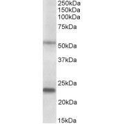 Western blot analysis of Human Prostate lysate (35 µg protein in RIPA buffer) using MMP3 antibody (0.2 µg/ml).