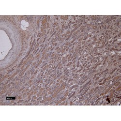 Matrix Metalloproteinase 3 / Stromelysin-1 (MMP3) Antibody