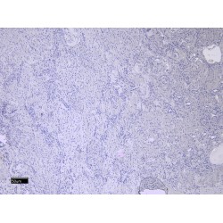 Matrix Metalloproteinase 3 / Stromelysin-1 (MMP3) Antibody