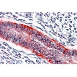 Matrilysin (MMP7) Antibody
