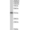 Monoacylglycerol-O-Acyltransferase 2 (MOGAT2) Antibody