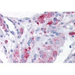 Metastasis Associated Protein 1 (MTA1) Antibody