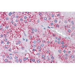 Metastasis Associated Protein 1 (MTA1) Antibody
