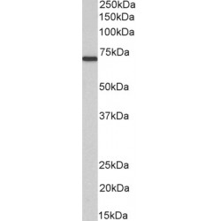 Myotubularin (MTM1) Antibody