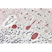 abx432995