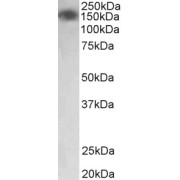 abx433005