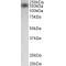 Myosin Light Chain Kinase (MYLK) Antibody