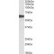 Myotilin (MYOT) Antibody