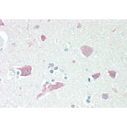 Neuroserpin (SERPINI1) Antibody