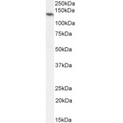 abx433039 (2 µg/ml) staining of Human Ovary lysate (35 µg protein in RIPA buffer). Primary incubation was 1 hour. Detected by chemiluminescence.