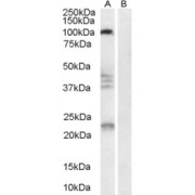 abx433045 (0.3 µg/ml) staining of Human Brain lysate (35 µg protein in RIPA buffer) with (B) and without (A) blocking with the immunising peptide. Primary incubation was 1 hour. Detected by chemiluminescence.