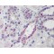 NADPH Oxidase Organizer 1 (NOXO1) Antibody
