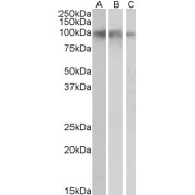 abx433059 (0.05 µg/ml) staining of Human Hippocampus (A), Cerebral Cortex (B) and Cerebellum (C) lysates (35 µg protein in RIPA buffer). Primary incubation was 1 hour. Detected by chemiluminescence.