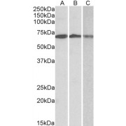 abx433065 (0.3 µg/ml) staining of Daudi (A), Jurkat (B) and K562 (C) lysates (35 µg protein in RIPA buffer). Primary incubation was 1 hour. Detected by chemiluminescence.