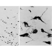 abx433083 (0.05 µg/ml staining of PFA-perfused cryosection of Human Hypothalamus. Antigen retrieval with citrate buffer pH 6 at 80C for 30min, HRP-staining with Ni-DAB after Biotin-SP-antigoat amplification. Data obtained by Prof. Erik Hrabovszky, Inst, Exp, Med., Budapest, Hungary.