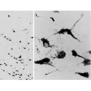 abx433083 (0.05 µg/ml staining of PFA-perfused cryosection of Human Hypothalamus. Antigen retrieval with citrate buffer pH 6 at 80C for 30min, HRP-staining with Ni-DAB after Biotin-SP-antigoat amplification. Data obtained by Prof. Erik Hrabovszky, Inst, Exp, Med., Budapest, Hungary.