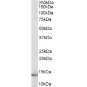 abx433095 (0.15 µg/ml) staining of adenovirus-mediated gene transfer in Rat Heart cells 1) Untransfected, 2) transient transfection with Human PVALB. 3) Untransfected Rat Skeletal Muscle. Detected by chemiluminescence.