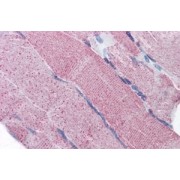 abx433102 (5 µg/ml staining of paraffin embedded Human Skeletal Muscle. Steamed antigen retrieval with citrate buffer pH 6, AP-staining.