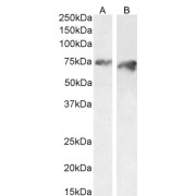 abx433104