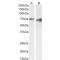 Proprotein Convertase Subtilisin/Kexin Type 9 (PCSK9) Antibody