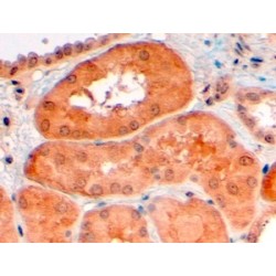 Proprotein Convertase Subtilisin/Kexin Type 9 (PCSK9) Antibody