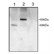 abx433107 staining (1 µg/ml) of COS cell lysates (25µg protein): transfected with Human PDE4D1 (1), transfected with Human PDE4D3 (2), untransfected (3). Primary incubation was 1 hour. Detected by chemiluminescence.