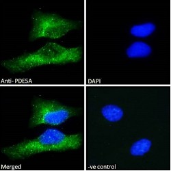 Phosphodiesterase 5A (PDE5A) Antibody