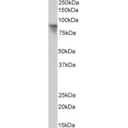 abx433115 (0.1 µg/ml) staining of Human Breast cancer lysate (35 µg protein in RIPA buffer). Primary incubation was 1 hour. Detected by chemiluminescence.