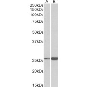 abx433118 (0.3 µg/ml) staining of Human Heart (A) and Liver (B) lysates (35 µg protein in RIPA buffer). Primary incubation was 1 hour. Detected by chemiluminescence.