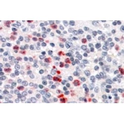 Peptidoglycan Recognition Protein-S (PGRP-S) Antibody