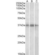 abx433128 (1 µg/ml) staining of Daudi, (A) Jurkat (B) and Jurkat nuclear (C) lysates (35 µg protein in RIPA buffer). Primary incubation was 1 hour. Detected by chemiluminescence